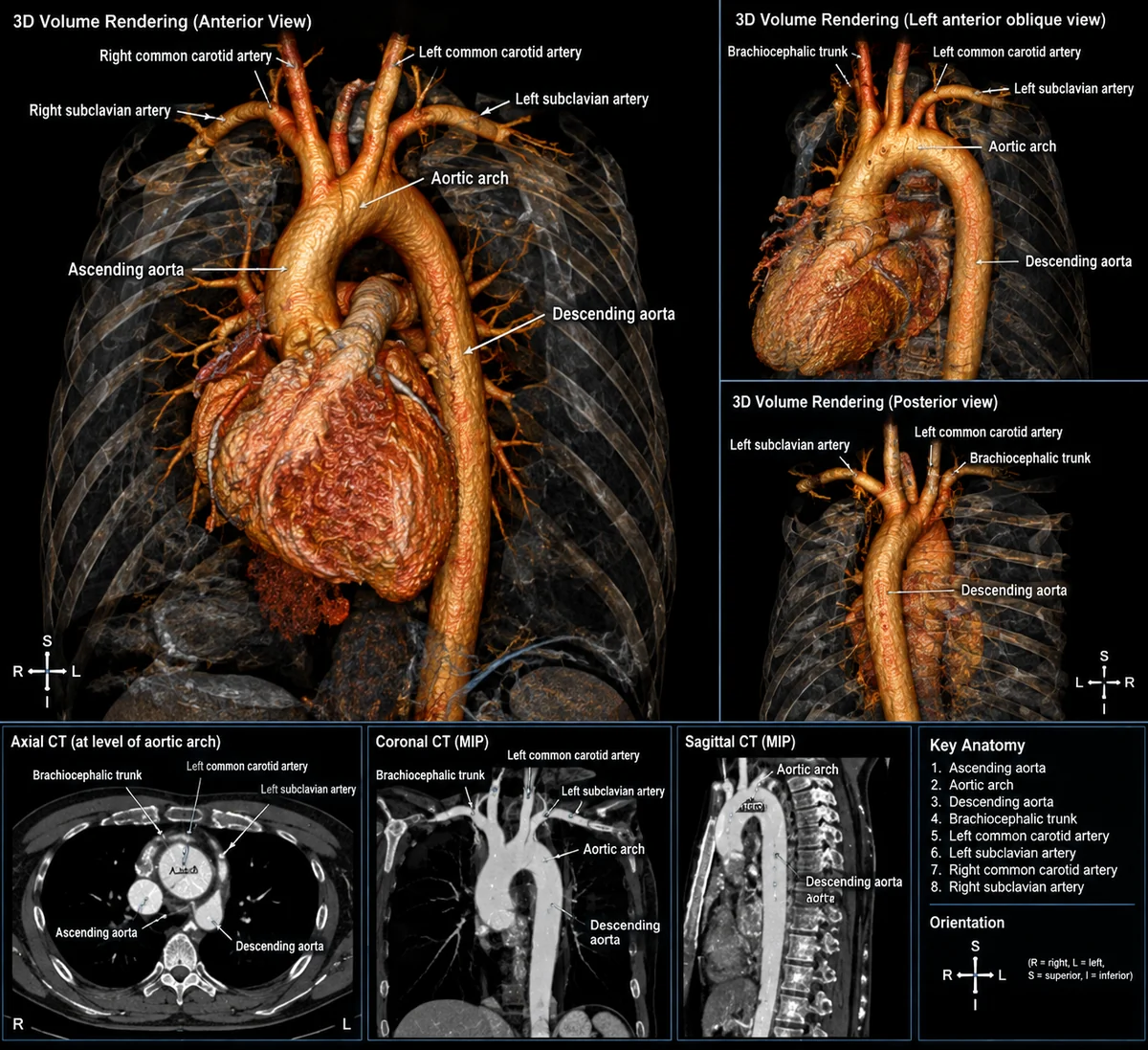 GPT-Image 2.5 生成的正常主動脈 3D CT 重組影像與斷層切面,含英文標示